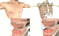 Patient information medical animation series.