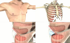 Patient information medical animation series.